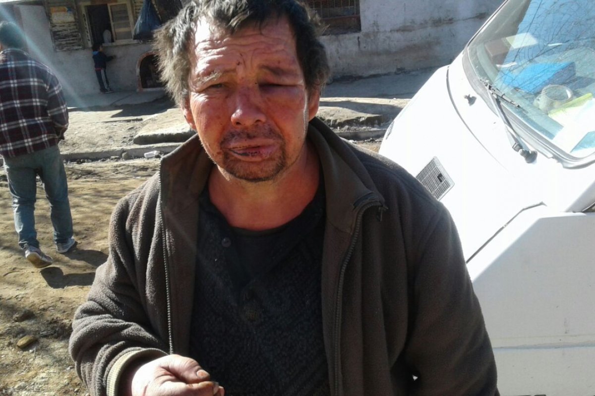 Tiburcio Talavera sufri&oacute; una brutal golpiza